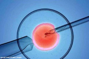 液氮储存